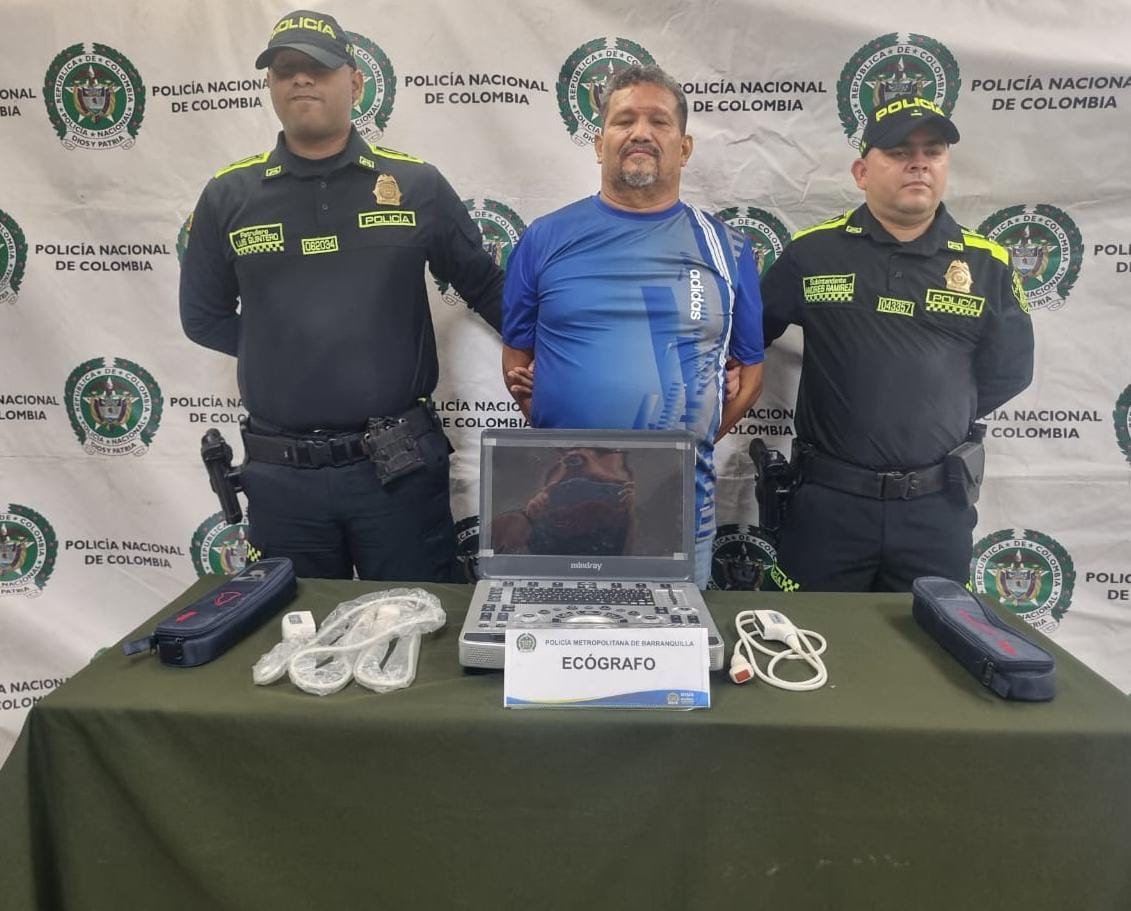UNA PERSONA CAPTURADA Y UN ECÓGRAFO PEDIÁTRICO AVALUADO EN CIEN MILLONES DE PESOS FUE RECUPERADO